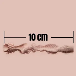 10cm