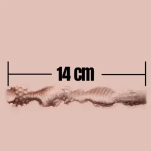 14cm