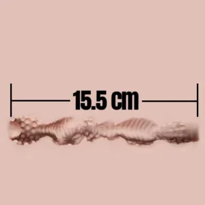 15.5cm
