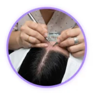 Implanted Hair